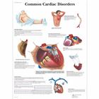 Common Cardiac Disorders, 1001526 [VR1343L], Kardiovaszkuláris rendszer