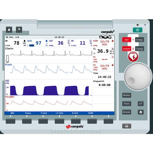 corpuls3 Patient Monitor Screen Simulation for REALITi 360, 8000967, AUTOMATIZÁLT KÜLSŐ DEFIBRILLÁTOR TRÉNEREK (AED)