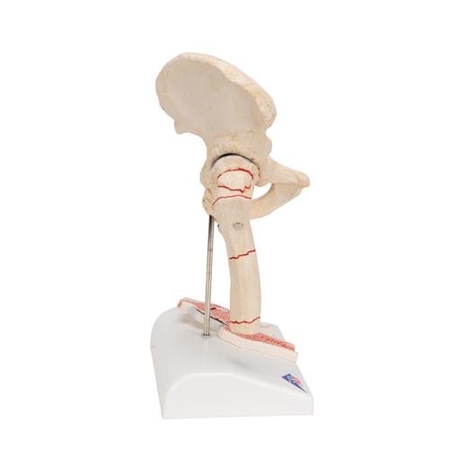 Combcsonttörés és csípőízületi gyulladás - 3B Smart Anatomy, 1000175 [A88], Ízületi modellek