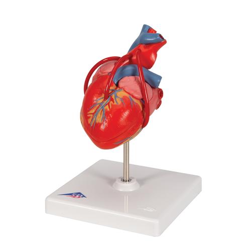 Klasszikus szív bypass-szal, 2 részes, 1017837 [G05], Szív és érrendszeri modellek