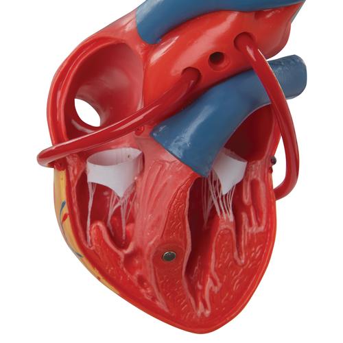 Klasszikus szív bypass-szal, 2 részes, 1017837 [G05], Szív és érrendszeri modellek