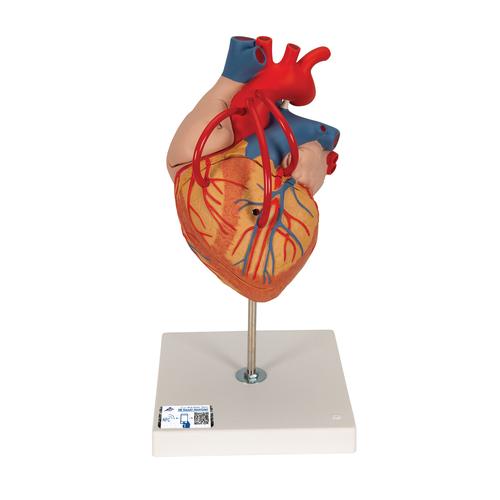 Szív bypass-szal, az eredeti méret 2-szerese, 4 részes - 3B Smart Anatomy, 1000263 [G06], Szív és érrendszeri modellek