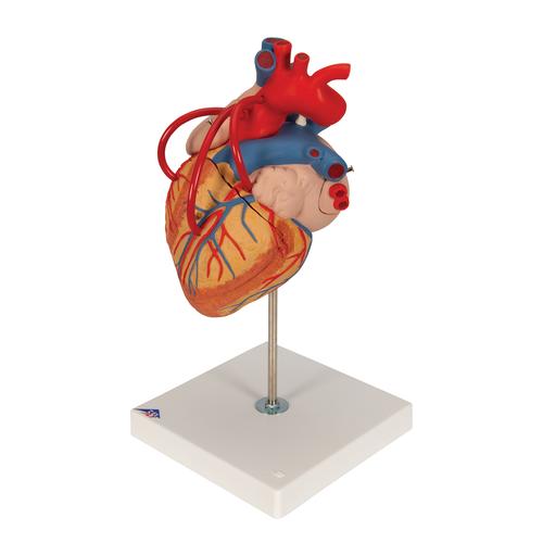 Szív bypass-szal, az eredeti méret 2-szerese, 4 részes - 3B Smart Anatomy, 1000263 [G06], Szív és érrendszeri modellek