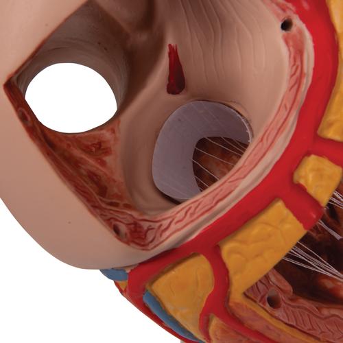 Szív, az eredeti méret 2-szerese, 4 részes - 3B Smart Anatomy, 1000268 [G12], Szív és érrendszeri modellek