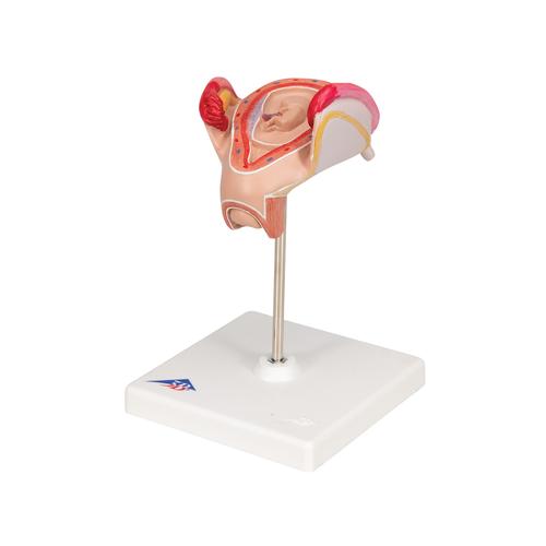 Embrió modell, 2. hónap - 3B Smart Anatomy, 1000323 [L10/2], Ember