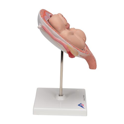 5. hónapos ikermagzatok, normál pozíció - 3B Smart Anatomy, 1000328 [L10/7], Terhességi modellek