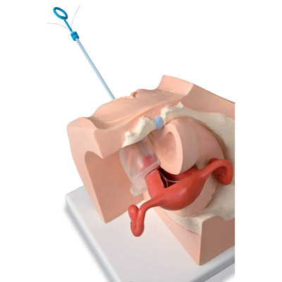 Nőgyógyászati modell - fogamzásgátlási eszközök szemléltetéséhez, 1013705 [P53], Női egészségnevelés