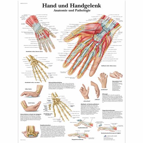 Hand und Handgelenk - Anatomie und Pathologie, 4006576 [VR0171UU], Csontrendszer
