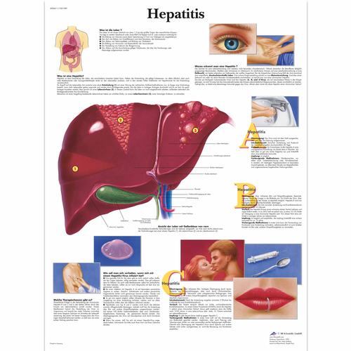 Hepatitis, 4006611 [VR0435UU], Metabolikus rendszer