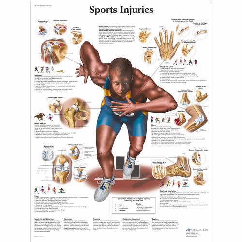 Sports Injuries, 1001494 [VR1188L], Izom