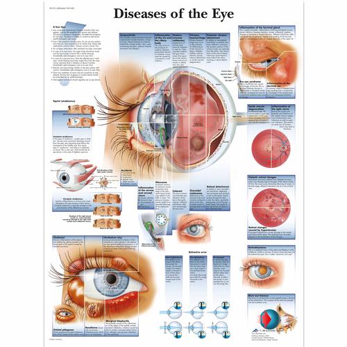 Diseases of the Eye, 1001498 [VR1231L], Szem