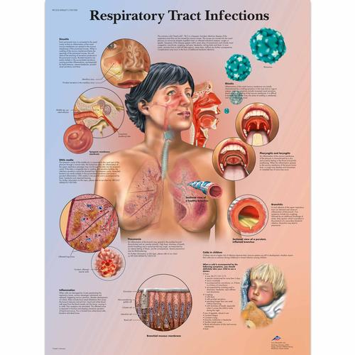 Respiratory Tract Infections, 1001508 [VR1253L], Légzőrendszer