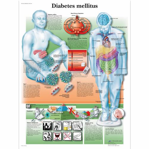 Diabetes mellitus, 4006694 [VR1441UU], Cukorbetegséggel kapcsolatos oktatási eszközök