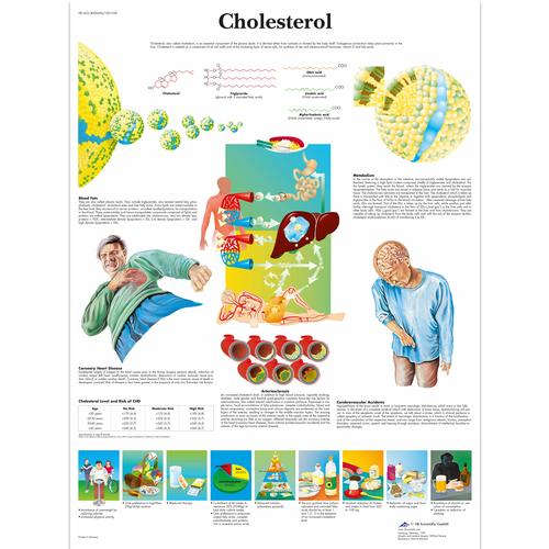 Cholesterol, 1001558 [VR1452L], Kardiovaszkuláris rendszer