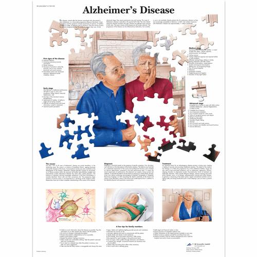 Alzheimer's Disease, 1001592 [VR1628L], Agy és idegrendszer