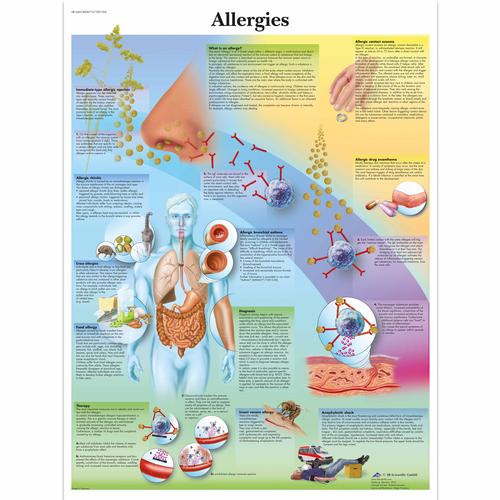 Allergies, 4006715 [VR1660UU], Immunrendszer