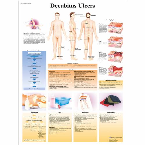 Decubitus Ulcers, 1001606 [VR1717L], Bőr