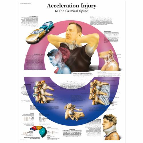 Acceleration Injury to the Cervical Spine, 4006724 [VR1761UU], Csontrendszer