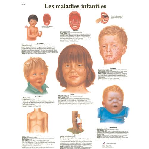 Les maladies infantiles, 1001780 [VR2741L], Paraziták, vírusok és bakteriális fertőzések