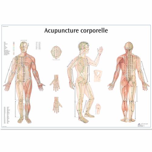 Acupuncture corporelle, 1001795 [VR2820L], Modellek