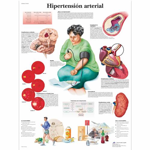 Hipertensión arterial, 1001863 [VR3361L], Kardiovaszkuláris rendszer