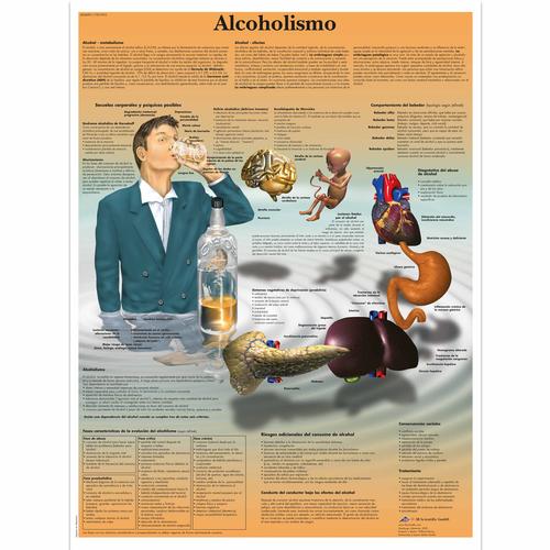Alcoholismo, 4006891 [VR3792UU], Függőség