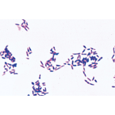 Baktérium alapkészlet -Francia nyelvű, 1003885 [W13011F], LIEDER mikrometszetek