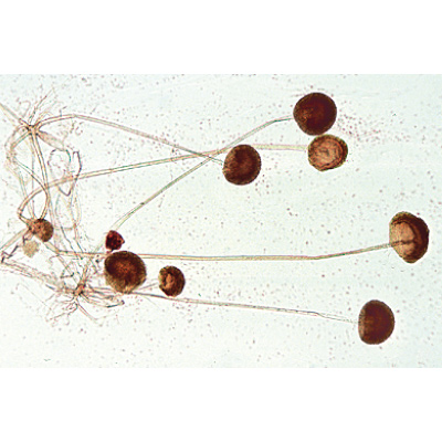 Gombák és zuzmók - Spanyol nyelvű, 1003895 [W13013S], LIEDER mikrometszetek