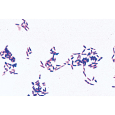 Patogén baktériumok - Angol nyelvű, 1004249 [W13424], Angol