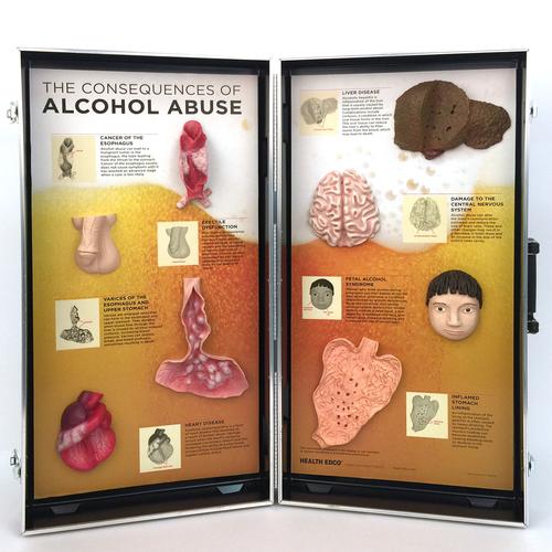 Az alkoholfogyasztás következményei – 3 dimenziós bemutató tábla, 1005582 [W43053], Kábítószerekkel és alkoholfogyasztással kapcsolatos oktatás