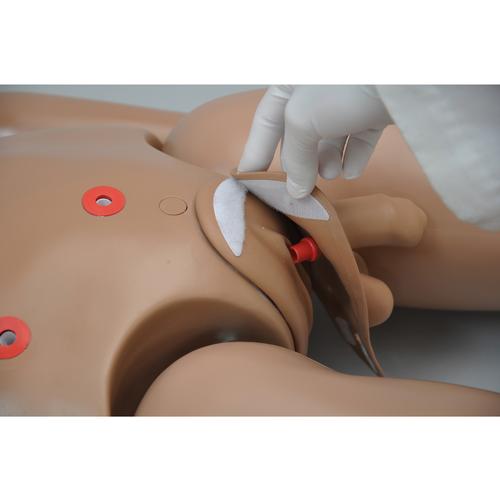 Clinical Cloe Patient Care Simulator with sculpted stomas, 1017542 [W45052], SZTÓMA GONDOZÁS