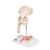 Combcsonttörés és csípőízületi gyulladás - 3B Smart Anatomy, 1000175 [A88], Ízületi gyulladással és csontritkulással kapcsolatos oktatás (Small)