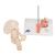 Combcsonttörés és csípőízületi gyulladás - 3B Smart Anatomy, 1000175 [A88], Ízületi gyulladással és csontritkulással kapcsolatos oktatás (Small)