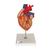 Szív bypass-szal, az eredeti méret 2-szerese, 4 részes - 3B Smart Anatomy, 1000263 [G06], Szív és érrendszeri modellek (Small)