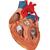 Szív bypass-szal, az eredeti méret 2-szerese, 4 részes - 3B Smart Anatomy, 1000263 [G06], Szív és érrendszeri modellek (Small)
