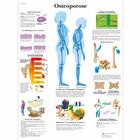 Osteoporose, 1001306 [VR0121L], Ízületi gyulladással és csontritkulással kapcsolatos oktatás