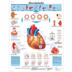 Herzinfarkt, 4006597 [VR0342UU], A szív egészségével és fitnesszel kapcsolatos oktatás