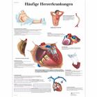 Häufige Herzerkrankungen, 1001362 [VR0343L], A szív egészségével és fitnesszel kapcsolatos oktatás