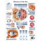 Diseases of the Eye, 1001498 [VR1231L], Szem