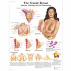 The Female Breast - Anatomy, Pathology and Self-Examination, 4006705 [VR1556UU], Női egészségnevelés