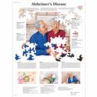 Alzheimer's Disease, 1001592 [VR1628L], Agy és idegrendszer