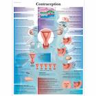 Contraception, 4006790 [VR2591UU], Terhesség és szülés