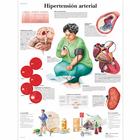 Hipertensión arterial, 1001863 [VR3361L], Kardiovaszkuláris rendszer