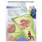 Incontinencia urinaria de la mujer, 4006864 [VR3542UU], Nőgyógyászat