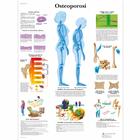 Osteoporosi, 1001967 [VR4121L], Ízületi gyulladással és csontritkulással kapcsolatos oktatás