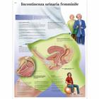 Incontinenza urinaria femminile, 4006950 [VR4542UU], Nőgyógyászat