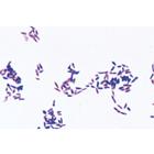 Patogén baktériumok - Portugál nyelvű, 1004148 [W13324P], Portugál
